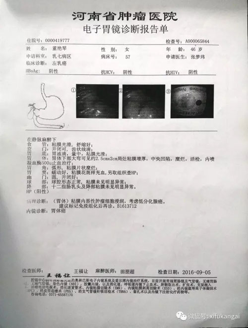 同时身患乳腺癌与胃癌 面对西医束手无策 单吃十个月