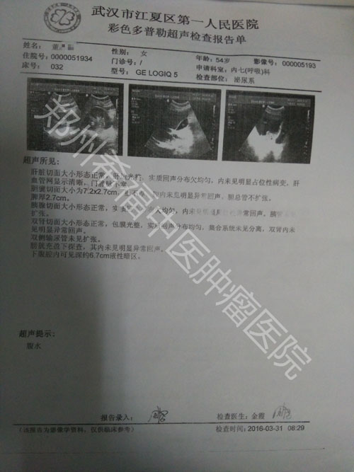 Ⅳ期卵巢癌病人中医治疗案例