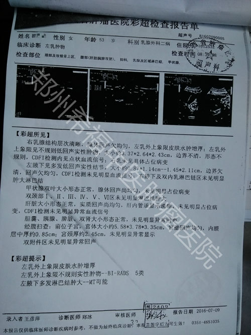 袁希福中医乳腺癌晚期骨转移案例