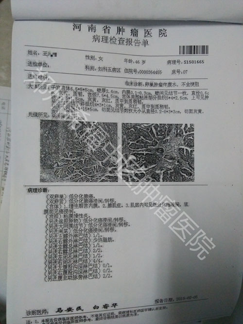 袁希福治疗卵巢癌真实案例