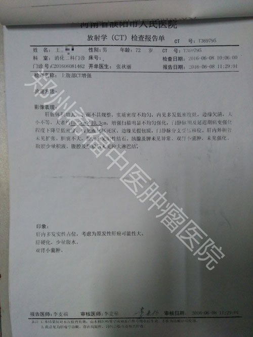 中医治肝癌的真实案例