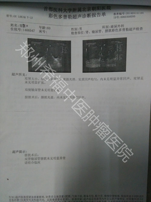 中医治疗膀胱癌成功案例