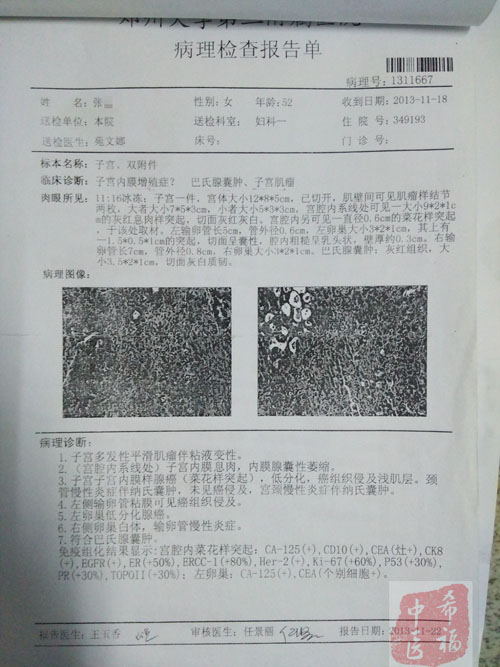 中医治乳腺癌,子宫内膜癌的真实案例