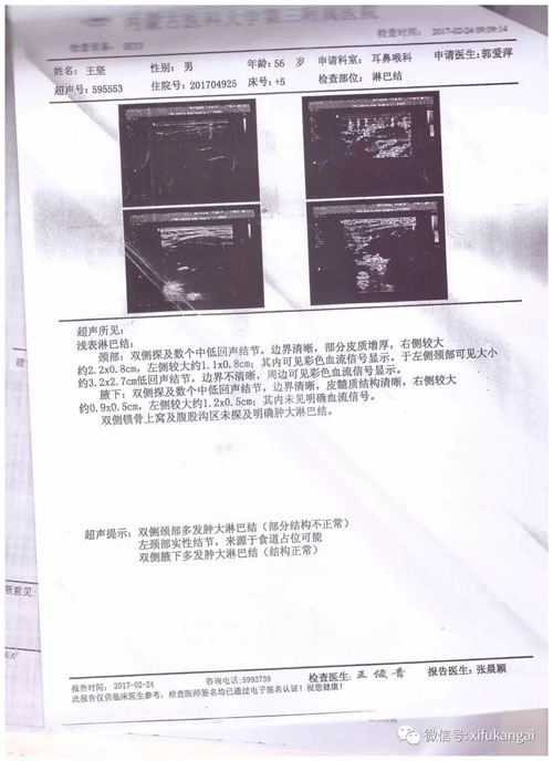 喉癌患者的两个抗癌心得