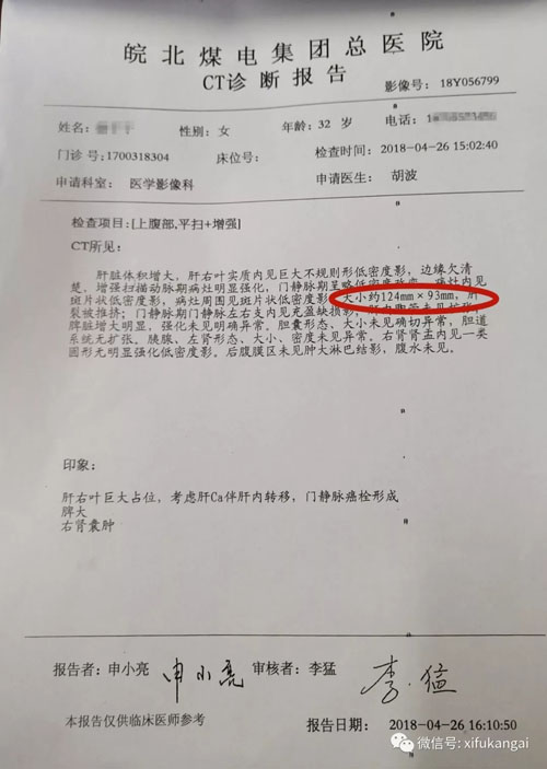 巨块型肝癌用中药 从病危到慢慢好转