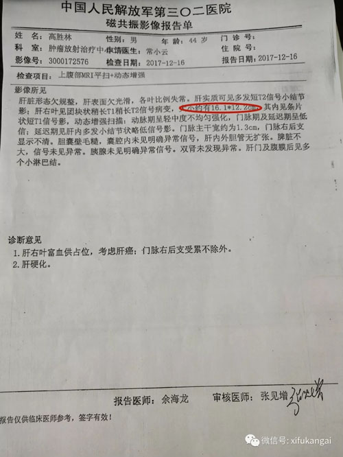 2017年12月份被确诊为肝癌,双肺多发结节,考虑转移,磁共振影像报告单