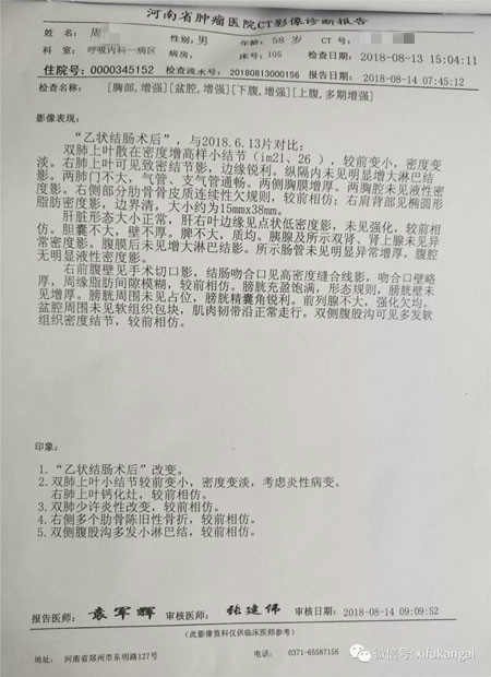 中西医结合乙状结肠癌肺转移患者获喜人疗效
