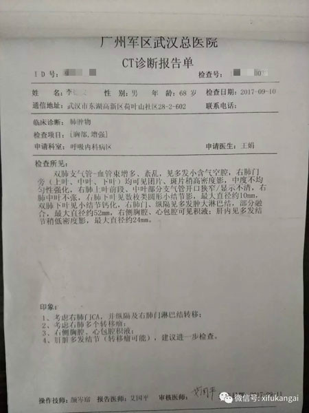 小细胞肺癌家属:袁院长是最可靠的!