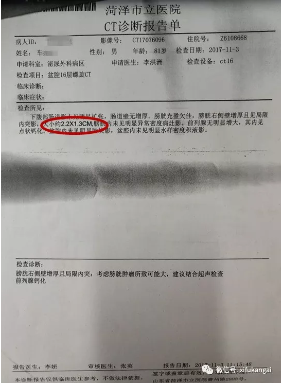 81岁高龄膀胱癌患者肿瘤消失的秘密