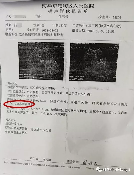 81岁高龄膀胱癌患者肿瘤消失的秘密