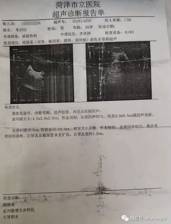 超声诊断报告单