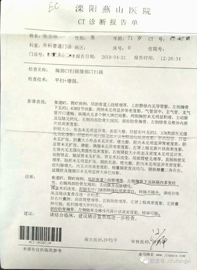 袁希福院长关于食道小细胞癌的治疗建议