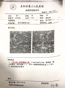 10年了，她说：“当初村里和自己一样的胆管癌1年都没过去……”