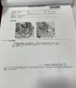 肺癌4年了，医生都说：“你这个病能控制成这个效果，非常不错！”