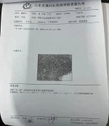 晚期肺癌，被判定“只有7个月”，结果现在5年了！