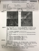 肺癌病人能捡1000多斤苞米？？