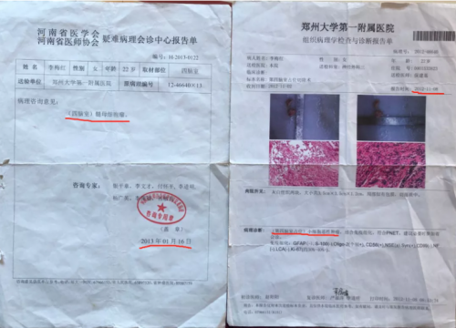 李梅红病理诊断