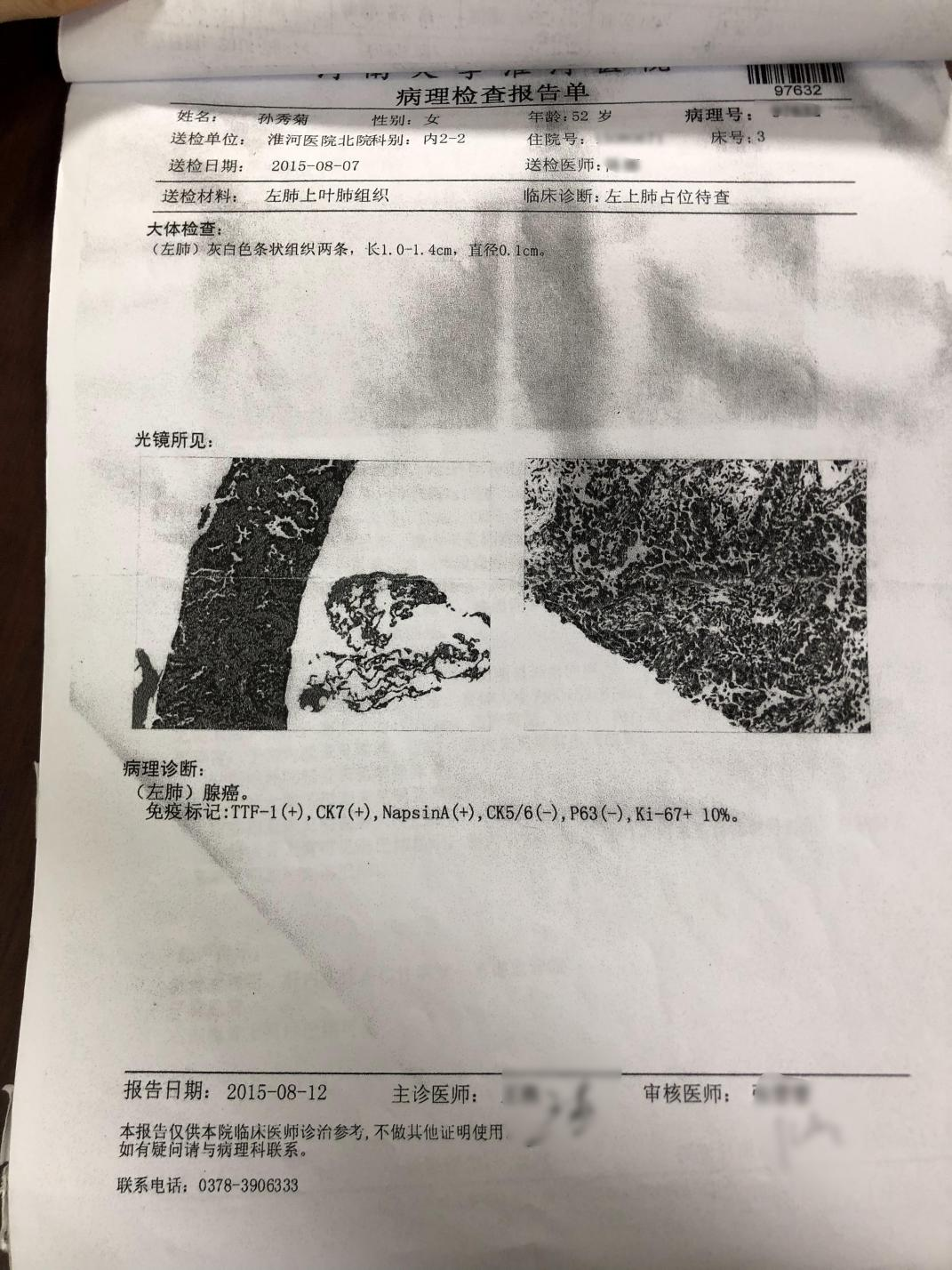 病理报告