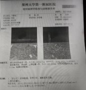 “手术≠没事了”，不做放化疗，用纯中医药，能预防术后复发吗？
