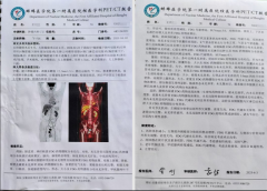 病历研讨 | 检查结果无异常，但有症状的患者如何治疗？