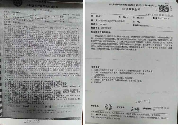 病历研讨 | 放化疗无法耐受，中医治疗如何？